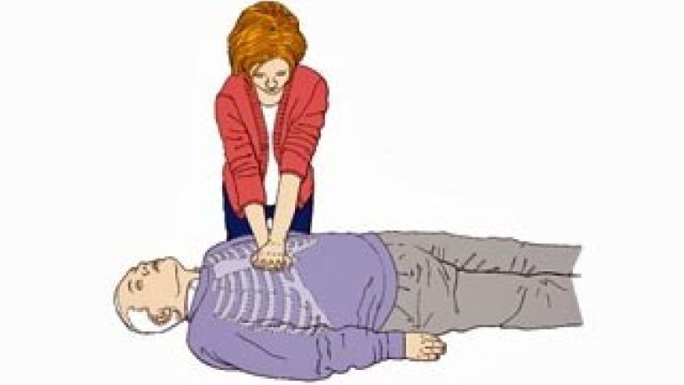 Frau legt bei einer liegenden Person die Handballen auf den Druckpunkt für eine Herzdruckmassage