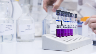 Water sample in the laboratory