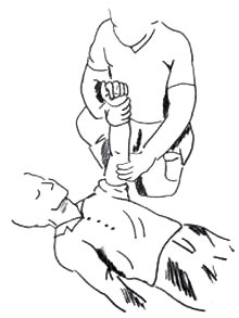 Lagerung bei Blutung: Person hlt den Arm einer liegenden Person hoch