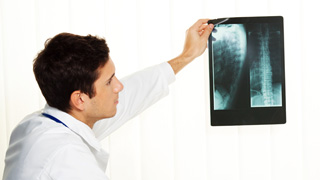 Ein Arzt hält ein Röntgenbild hoch.